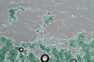 Trichoderma viride в микроскопе